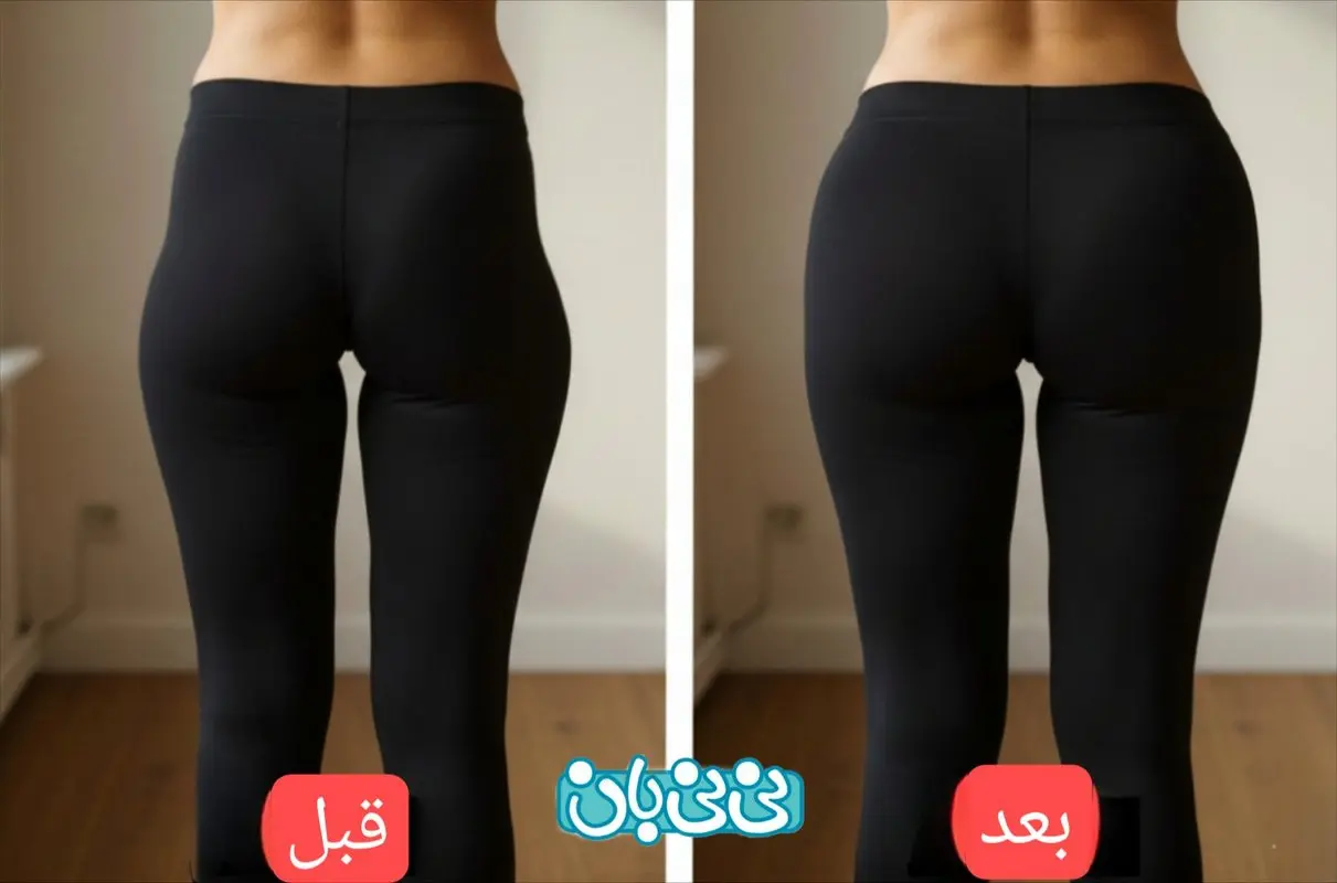 فیلر بادی چیست؟ بررسی جامع مزایا، کاربردها، ماندگاری، عوارض و مقایسه روش‌ها