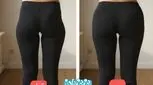 فیلر بادی چیست؟ بررسی جامع مزایا، کاربردها، ماندگاری، عوارض و مقایسه روش‌ها