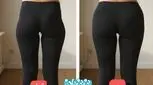 فیلر بادی چیست؟ بررسی جامع مزایا، کاربردها، ماندگاری، عوارض و مقایسه روش‌ها