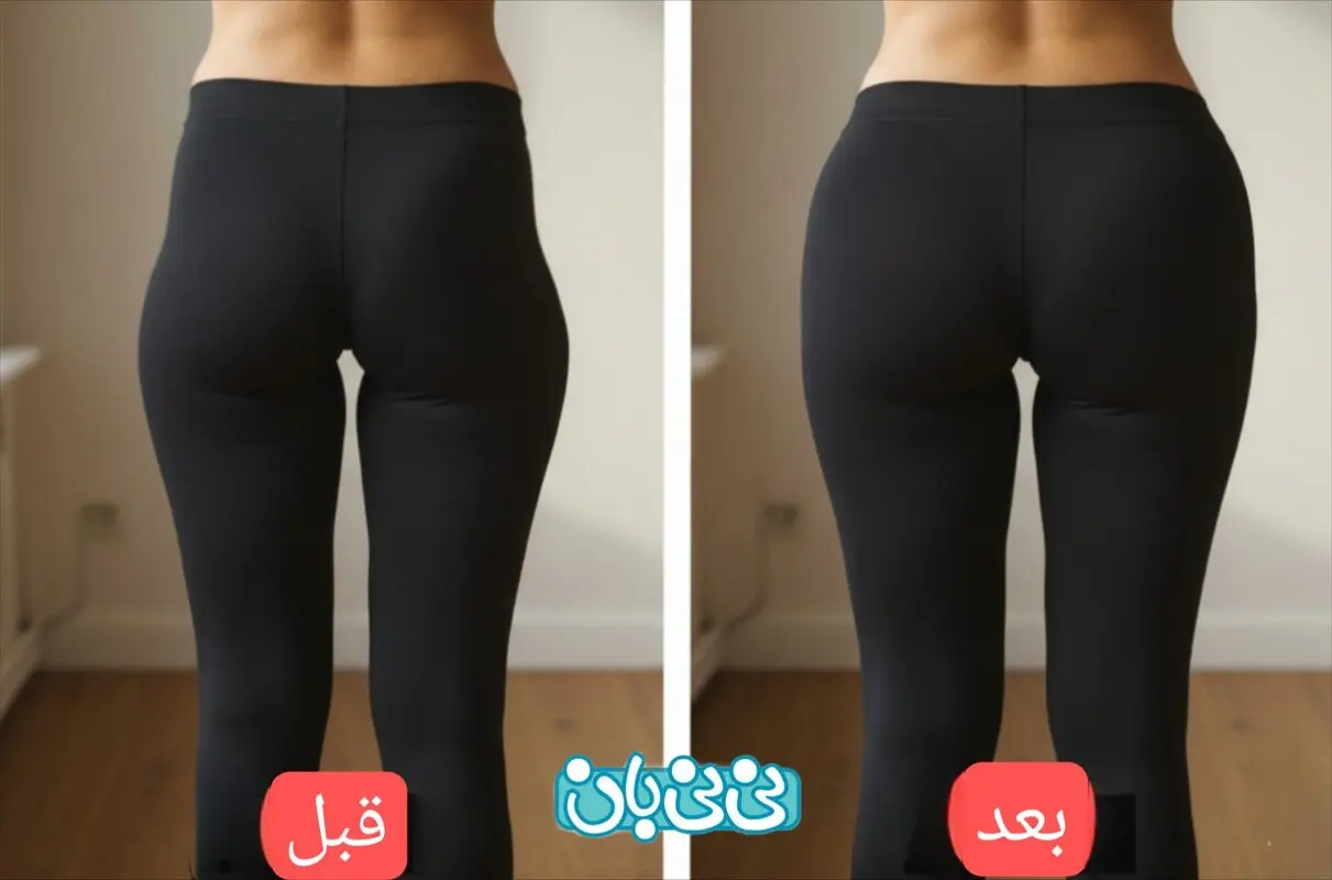 فیلر بادی چیست؟ بررسی جامع مزایا، کاربردها، ماندگاری، عوارض و مقایسه روش‌ها