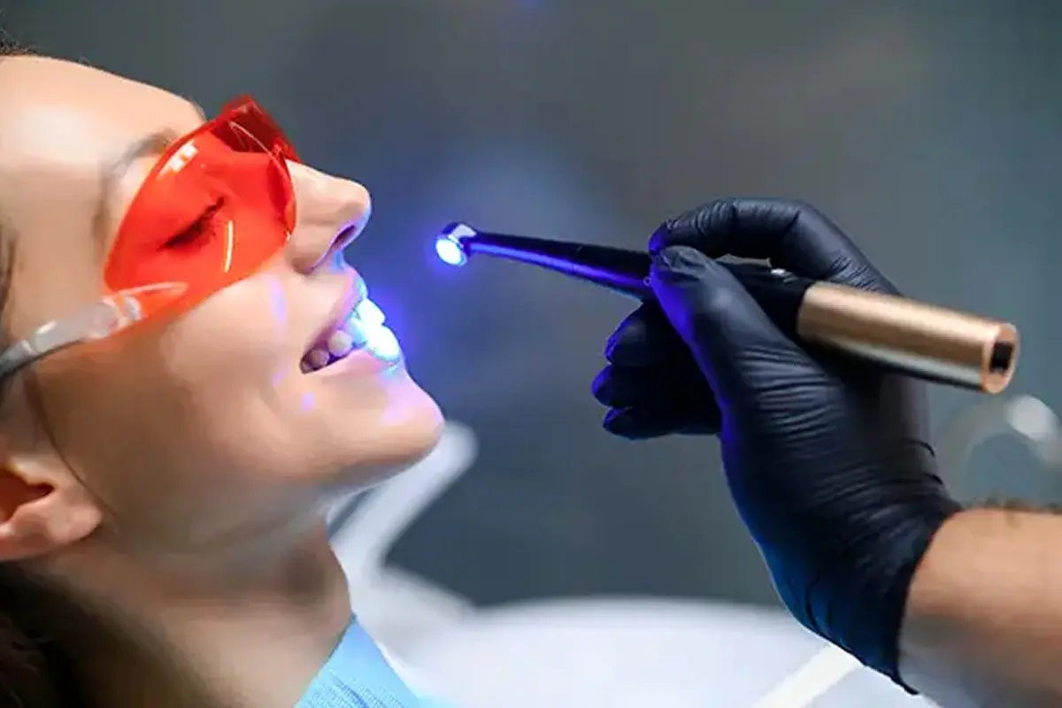 دستگاه لایت کیور ؛ نور آبی جادویی در دندانپزشکی