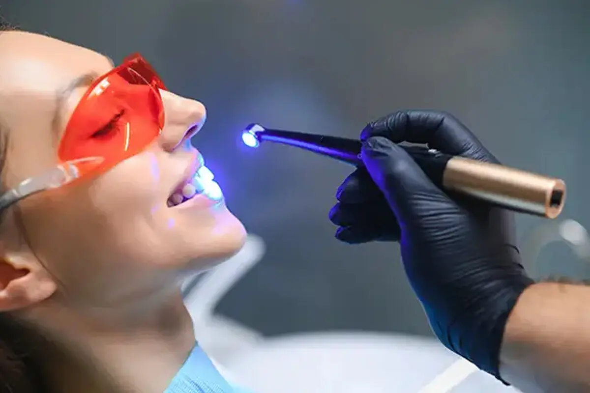 دستگاه لایت کیور ؛ نور آبی جادویی در دندانپزشکی