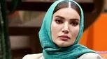 چطور معصومیت صورت خود را با بوتاکس و عمل زیبایی از بین ببریم؟! (عکس)