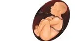 دلایل پیچیده شدن بند ناف دور گردن جنین