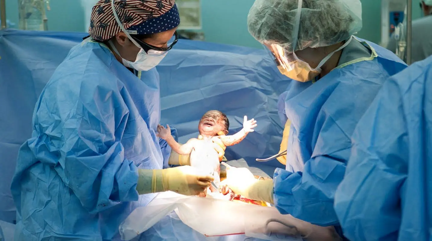 زایمان را به تقویم نسپارید!