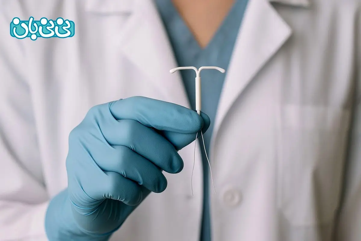 آی یو دی چیست و عملکرد آن چگونه است؟ نحوه گذاشتن + ۸ عارضه و مزایا IUD