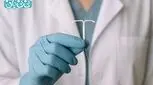 آی یو دی چیست و عملکرد آن چگونه است؟ نحوه گذاشتن + ۸ عارضه و مزایا IUD