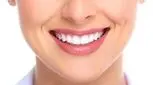 هزینه لمینت دندان در سال 1404 چقدر است؟