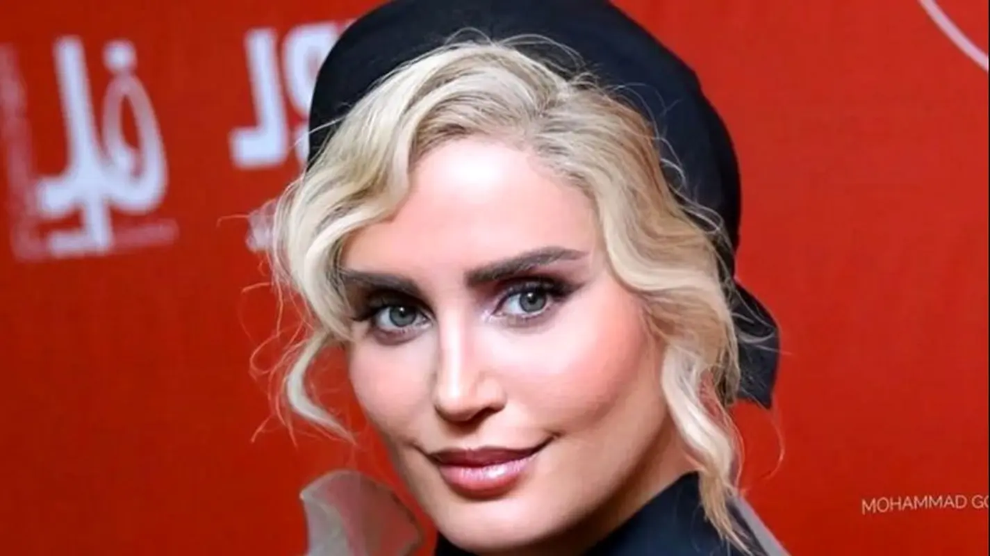 چهره نچرال و زیبای الناز شاکردوست در 19 سالگی / قبل عمل هم خاص بود !