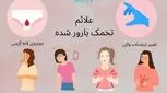 علائم تخمک بارور شده | نشانه‌ها و زمان دقیق تشخیص