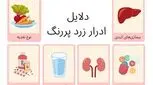ادرار زرد پررنگ نشانه چیست؟ 5 دلیل شایع و روش درمان 
