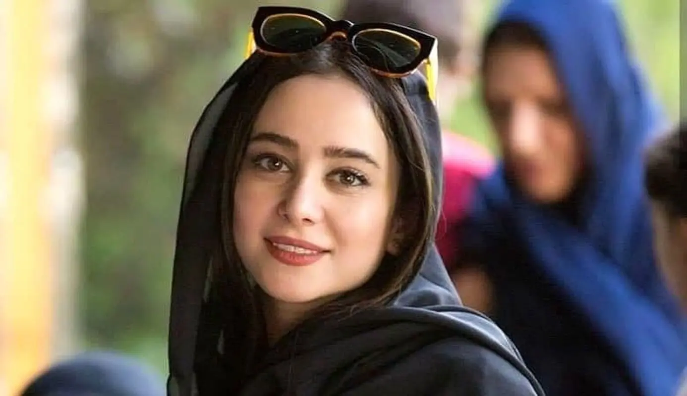 چهره جدید الناز حبیبی بعد از جراحی زیبایی / تغییرات خانم بازیگر در گذر زمان + عکس