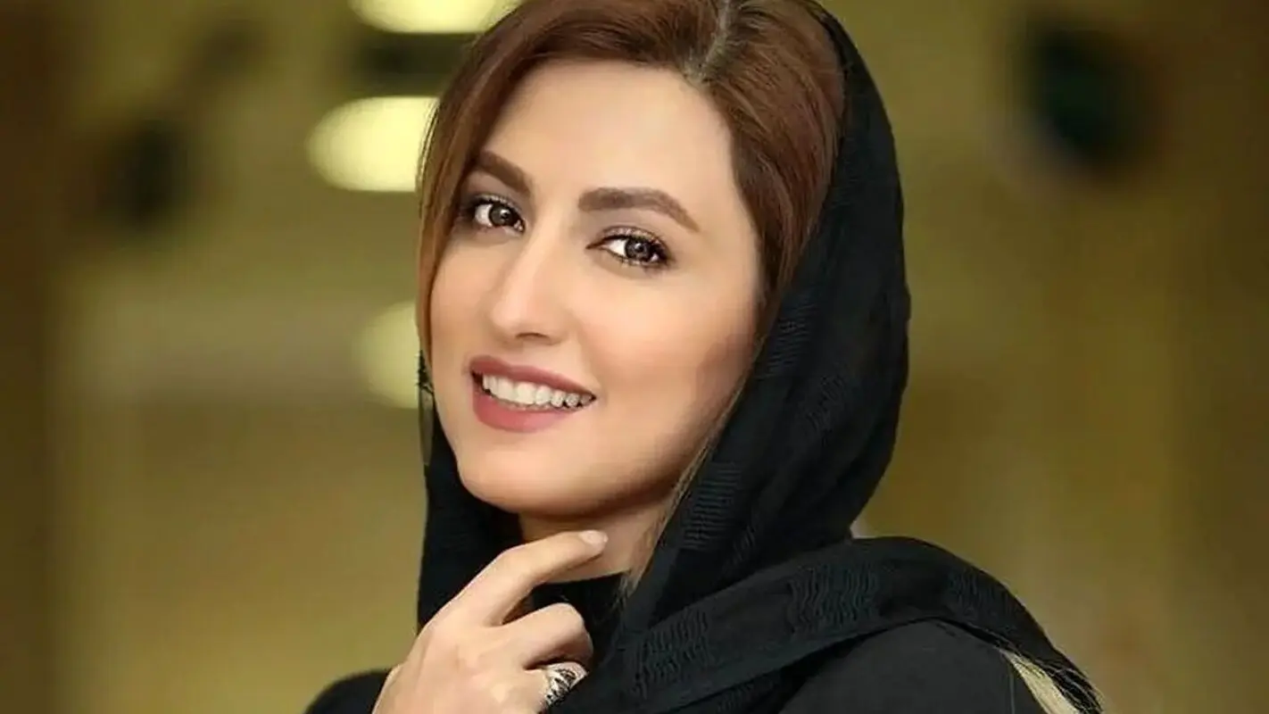 تغییر چهره سمیرا حسینی بعد از عمل زیبایی / الان خوشگله یا قبلا ؟!