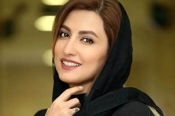 تغییر چهره سمیرا حسینی بعد از عمل زیبایی / الان خوشگله یا قبلا ؟!