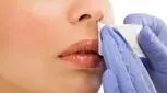 موهای زائد پشت لب را با ادویه های خانگی محو کنید