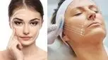 بازتعریف زیبایی در سال ۲۰۲۵؛ کاشت چانه، کشیدن پوست و درمان‌های احیاکننده