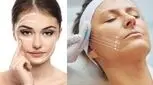 بازتعریف زیبایی در سال ۲۰۲۵؛ کاشت چانه، کشیدن پوست و درمان‌های احیاکننده