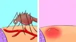 با نیش این حشره موذی چه کنیم؟