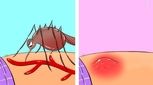با نیش این حشره موذی چه کنیم؟