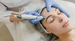 مراقبت های بعد از مزونیدلینگ: چطور از عوارض مزونیدلینگ جلوگیری کنیم؟

