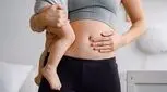 ریکاوری بعد از عمل سزارین؛ مدت زمان و نکات